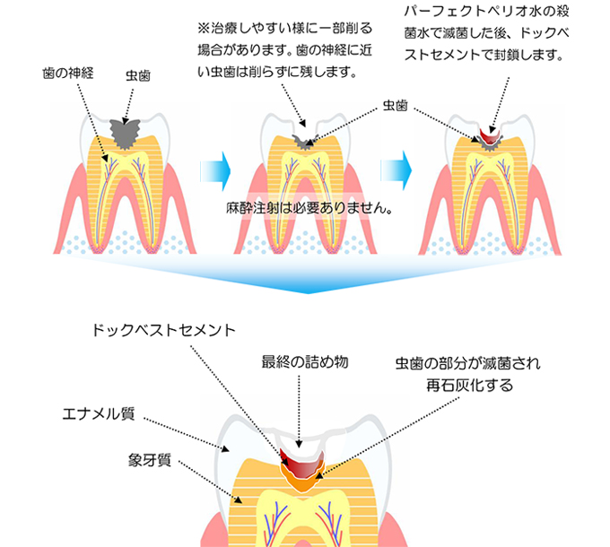 ドックベストセメント